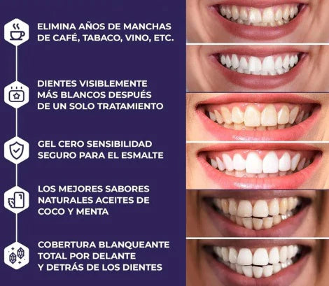 3D White - Kit Profesional de Blanqueamiento Dental 🦷