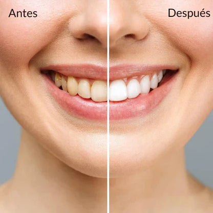 3D White - Kit Profesional de Blanqueamiento Dental 🦷