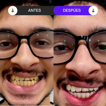🦷 HISMILE™ ORIGINAL – Blanquea al Instante + Cepillo de OBSEQUIO 🎁