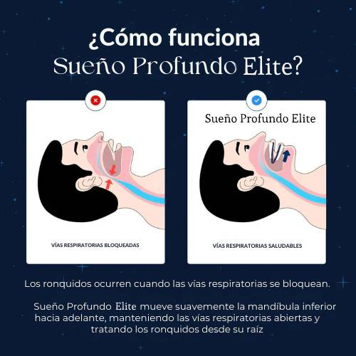 Sueño Profundo Elite™ Dispositivo Bucal ANTI - RONQUIDOS